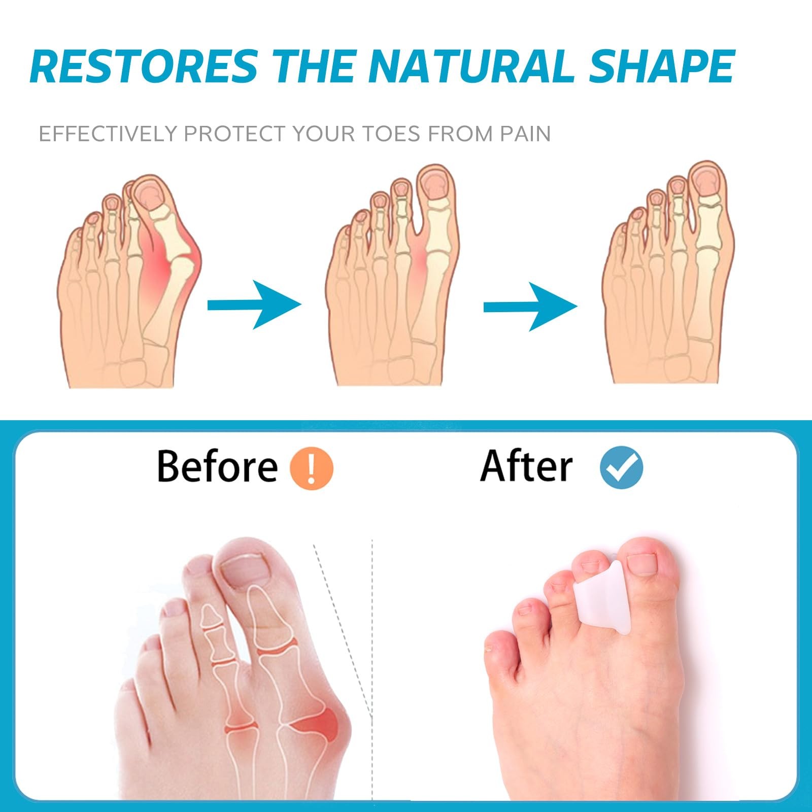 Hammer Toe Straightener Corrector – Toe Spacers Toe Separators for Bunion,Curled