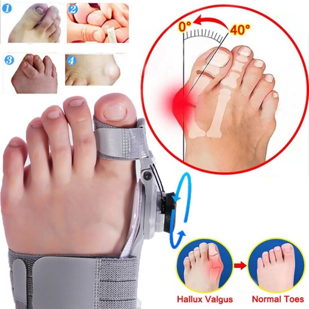 Adjustable Thumb Hallux Valgus Corrector and Toe Alignment Orthotic With knob