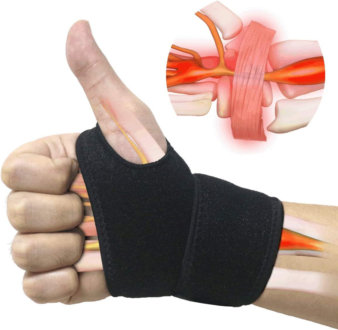 Muñequeras Soporte De Mano Para Túnel Carpiano Artritis Alivio Del Dolor Sport
