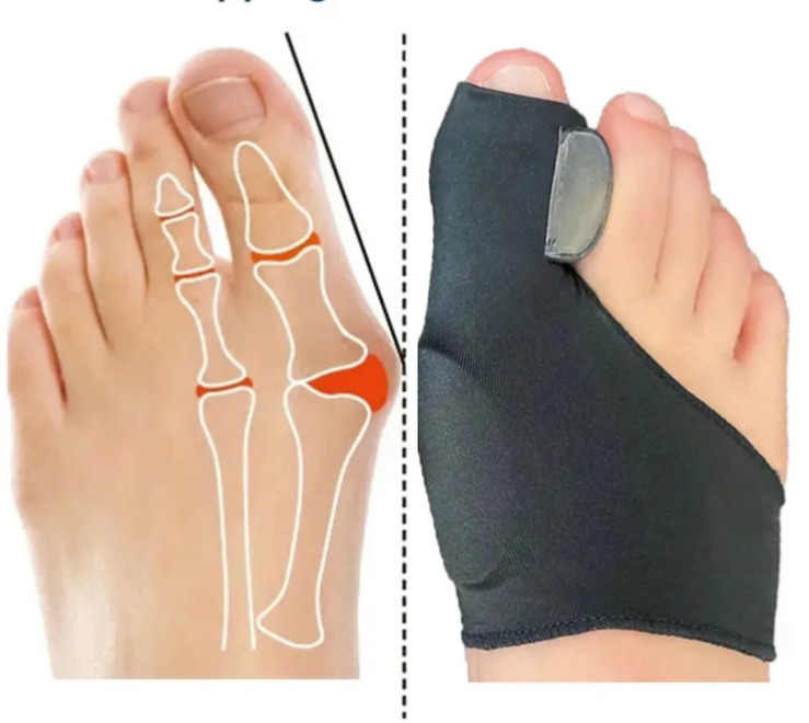 2Pcs Toe Separator Toe Valgus Bunion Corrector Feet Insoles Thumb Bone Adjuster