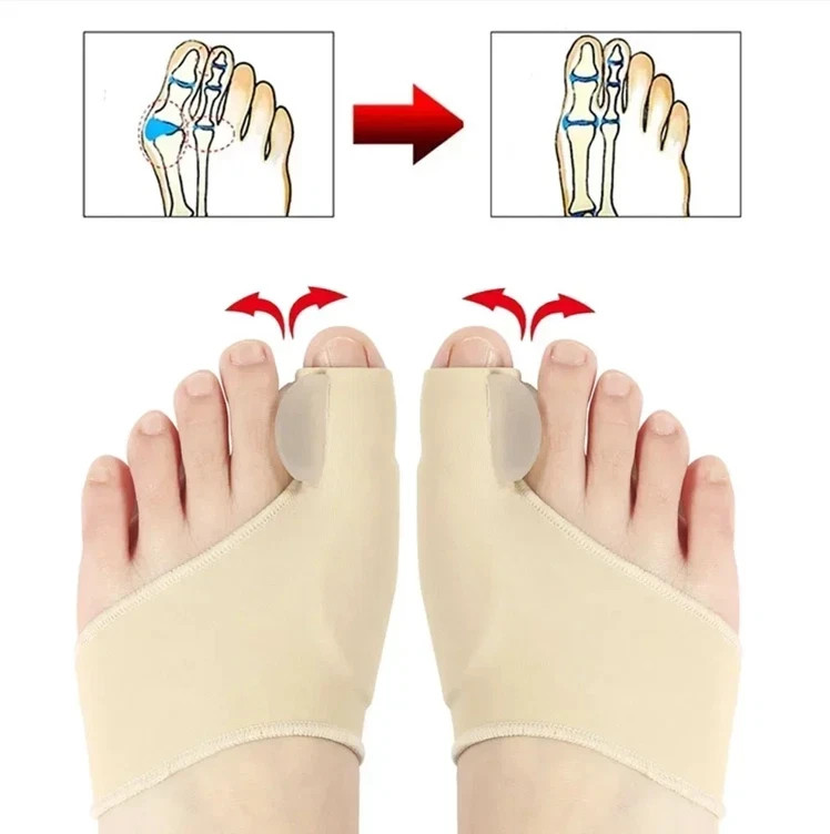 Recovist Bunion Corrector, Recovist Bunion Brace, Big Toe Straightener Bunions