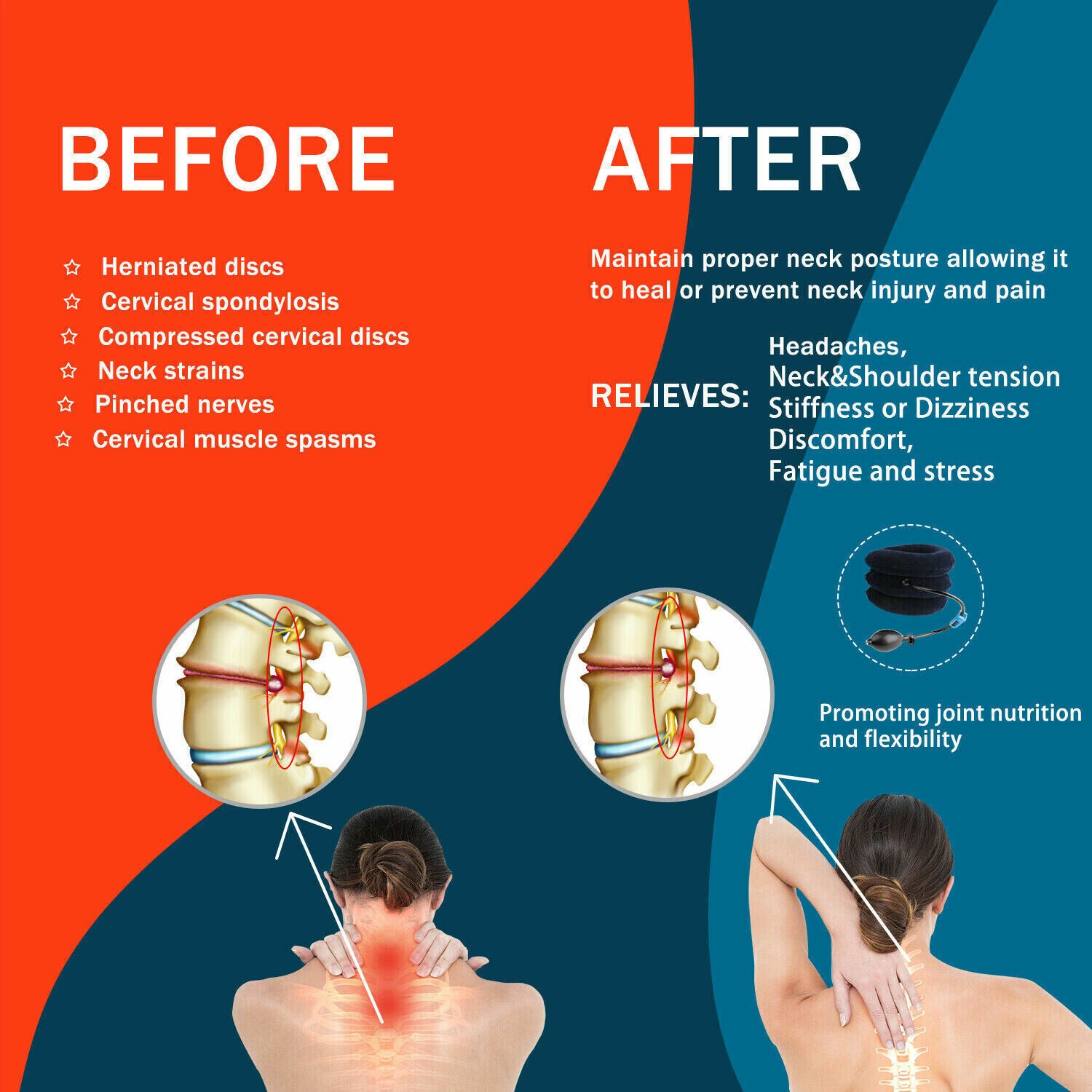 Cervical Neck Traction Device Collar Brace Support Pain Relief Stretcher Therapy