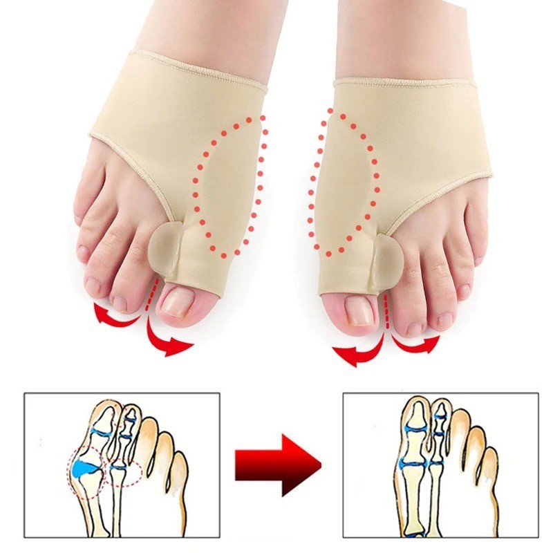 Toe Separator Hallux Valgus Bunion Corrector Orthotics Feet Pain Relief Sleeve