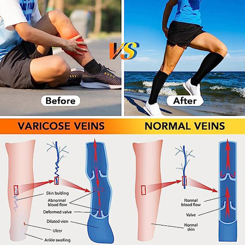 2 PAIRS Zip Up open Toe Compression Zipper Socks Calf Support Stocking Men Women