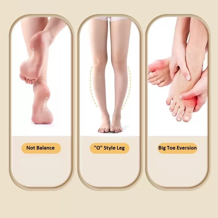 Foot Arch Trainer for Flat Feet, Plantar Fasciitis Relief &Arch Support Stren…
