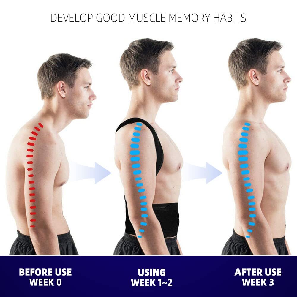 Posture Corrector Back Support for Compression Fracture, Hunched Back, Kyphosis