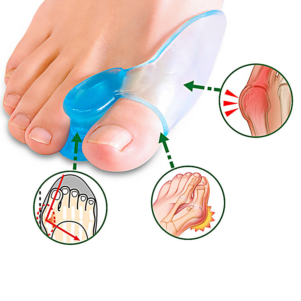 2X Big Toe Bunion Splint Straightener Corrector Hallux Valgus Foot Separator AE