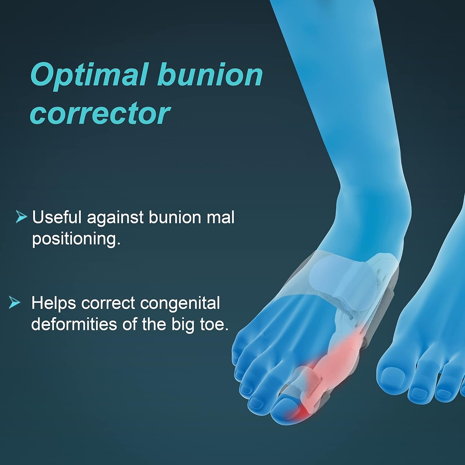 Bunion Splint, White, Universal Size, 1 Unit, Metal, Foam . BEST QUALITY