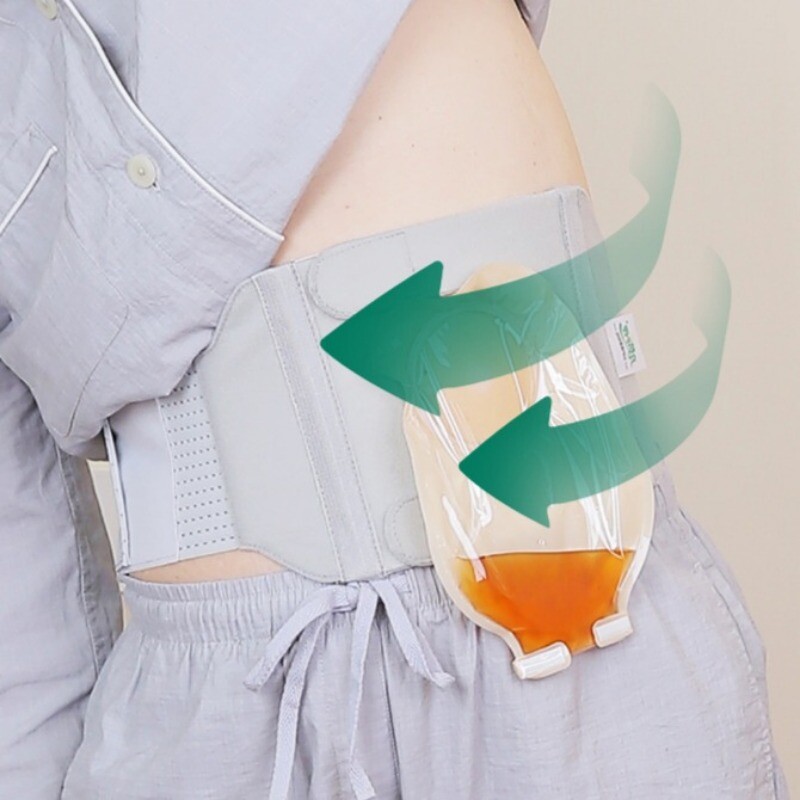 New U-shaped Stoma Adjustable Abdominal Support Belt Comfort for Ostomy Patients