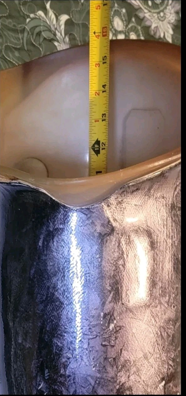Above Knee Prosthetic Socket Lefts leg Made of 100% Carbon Fiber it’s perfect.