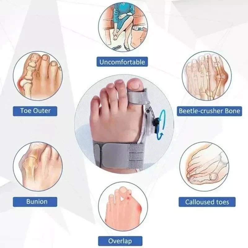 Adjustable Bunion Corrector Splint Hallux Valgus Toe Straightener Pain Relief