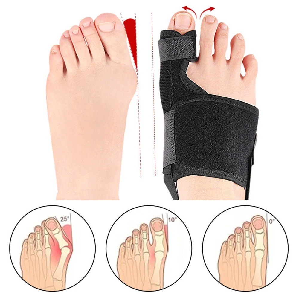 Bunion Corrector Big Toe Straightener Splint Brace for Men Women Foot Care