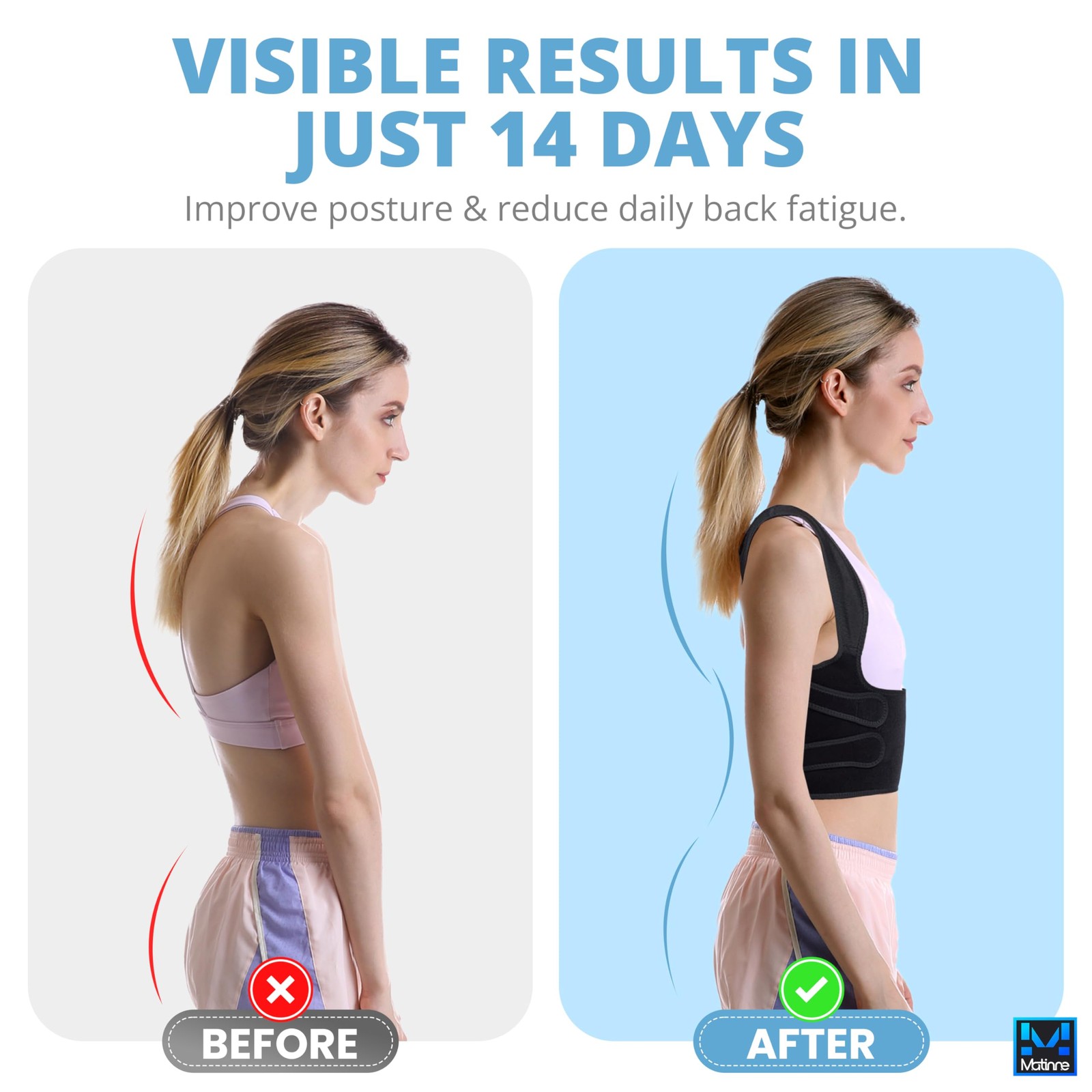 Posture Corrector for & Men – Adjustable Back Brace for Alignment, Pain & Bac…