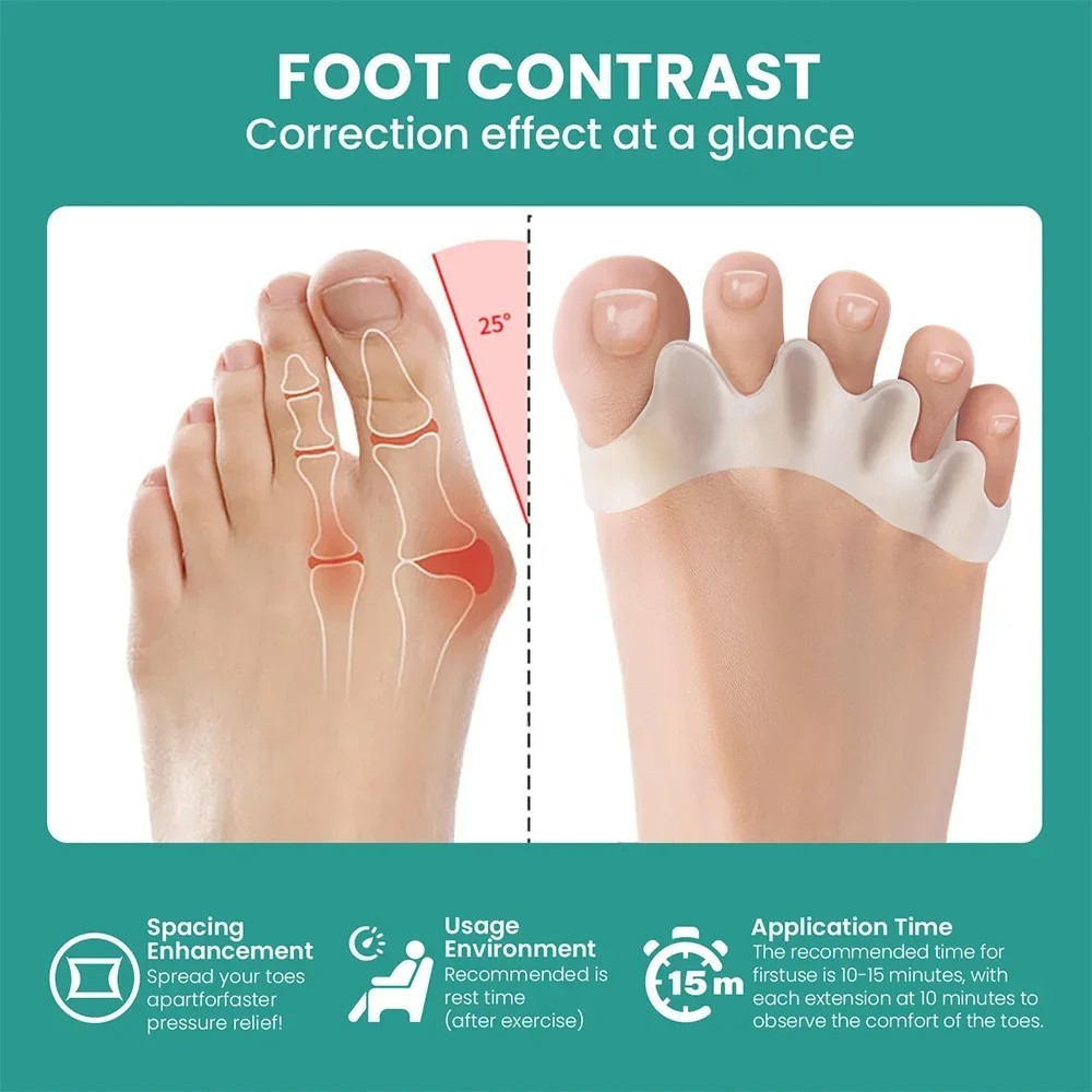 1 Pair Silicone Gel Bunion Toe Corrector Orthotics Straightener Separator Pain