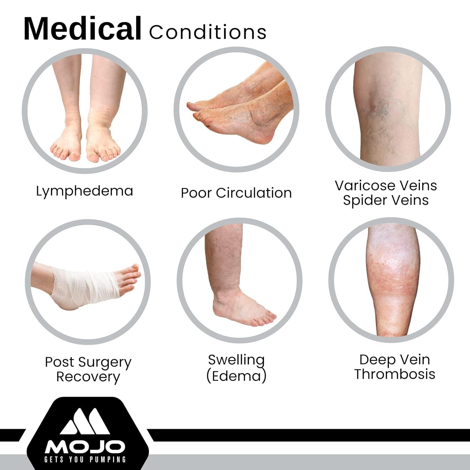 Mojo Toeless Compression Socks Women Men 20-30 mmHg Open Toe AB211