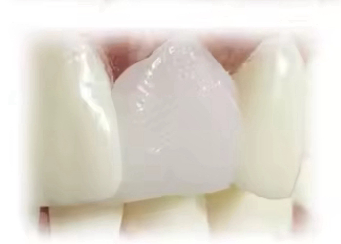 DIY Thermal Mold Beads for Crafts Denture Repair Cosplay Pellets 25g