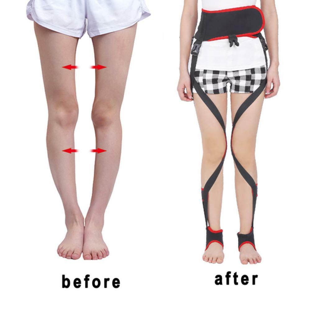 Adult Unisex O-leg X-leg Figure Correction Belt Strap Slim Legs Corrector Black