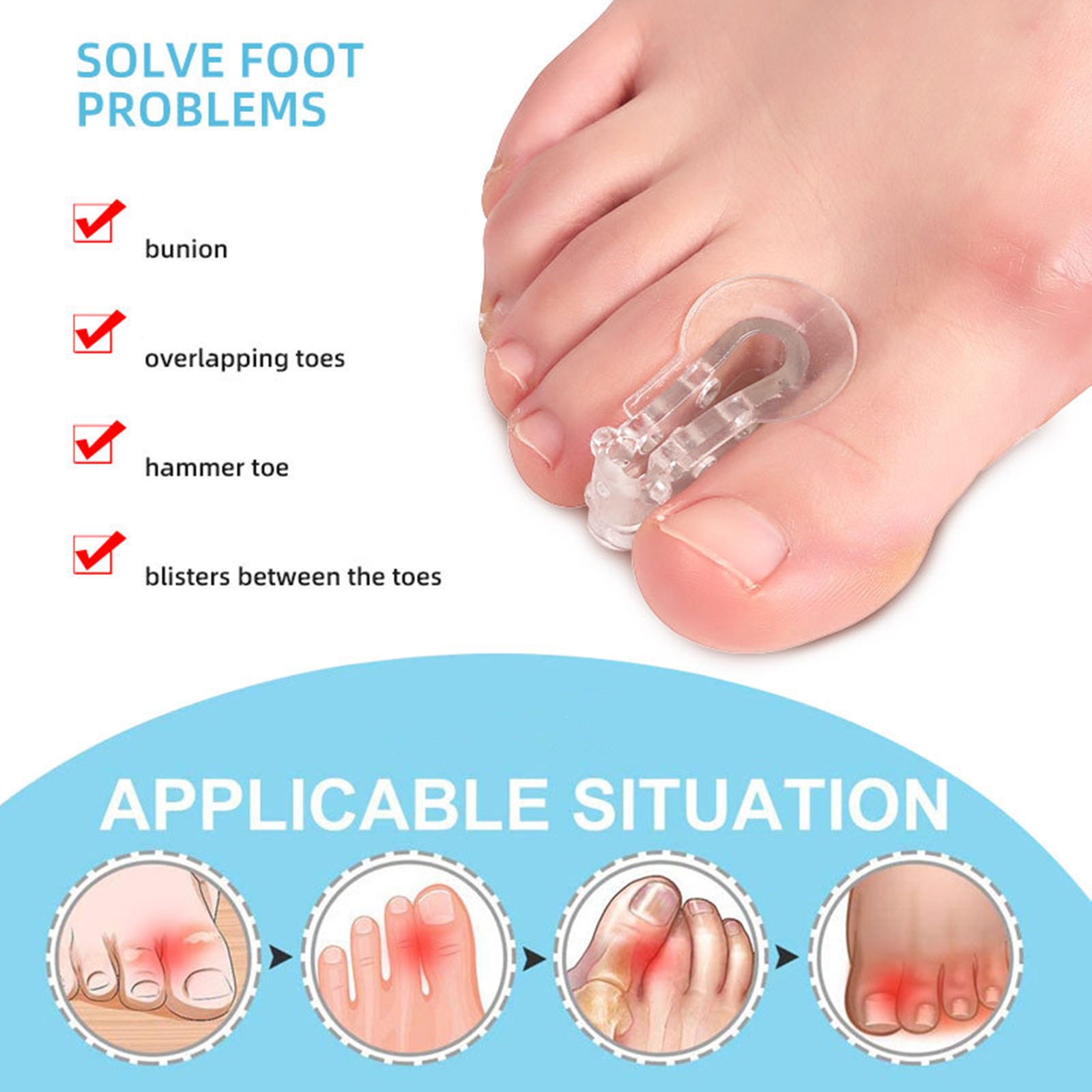 2* SEBS Toe Orthotic Pad For Overlap Prevention Phantom Exostosis Pain Relief