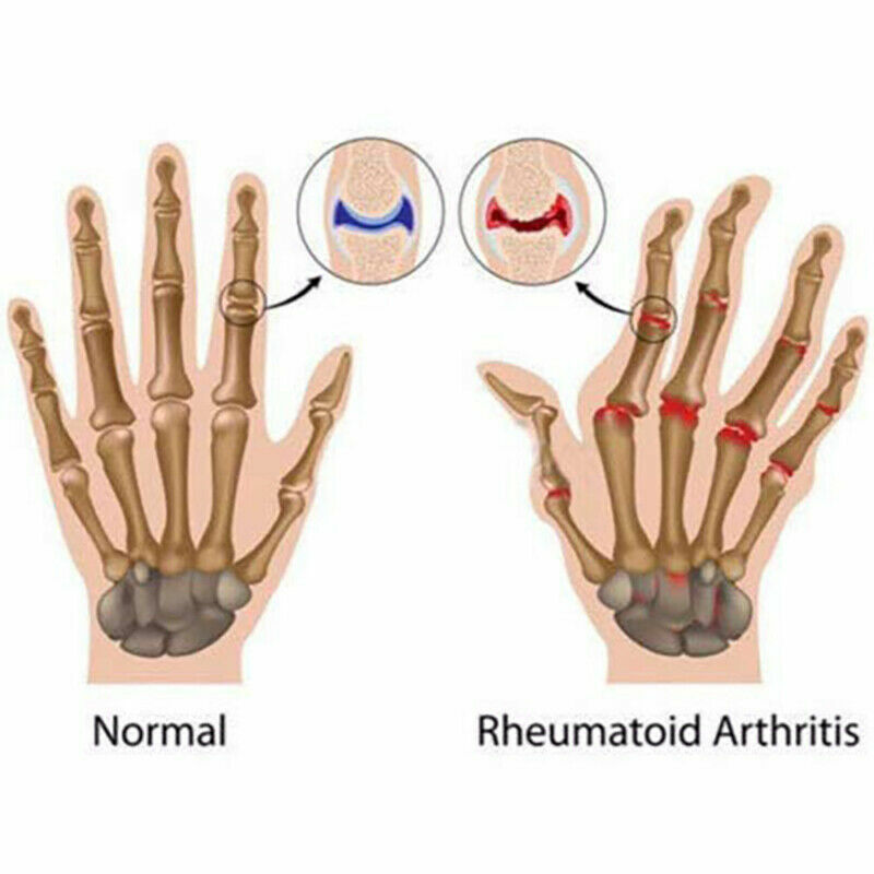 Copper Arthritis Hands Gloves As Seen on Tv Therapeutic Compression Pain Relief