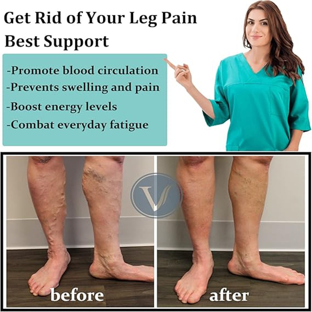 Compression Socks Thigh High Open Toe,20-30 mmHg Stockings Varicose Veins Travel
