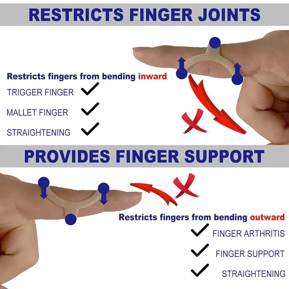 10Pcs Oval Finger Splints & Sleeves Kit, 6 Graduated Trigger Splint &…