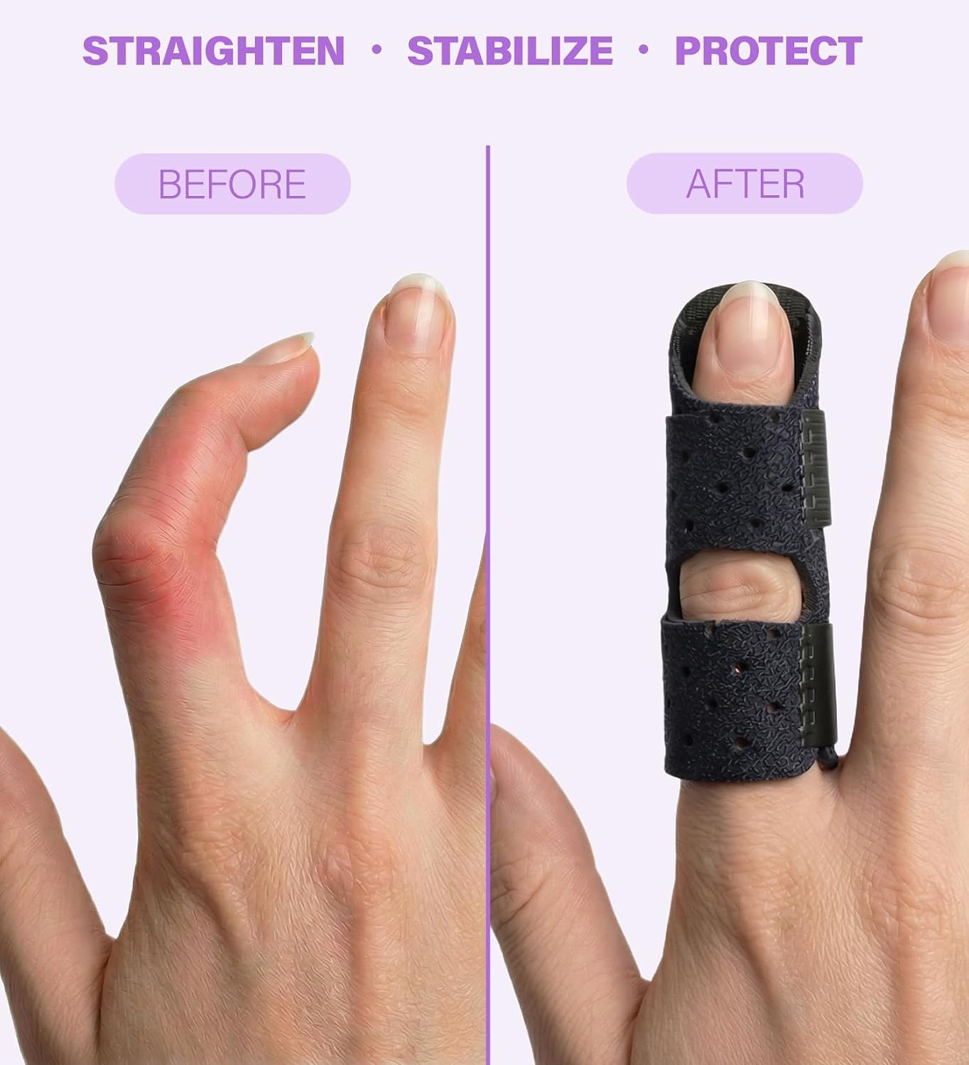 Finger Splint (2 Pack) – Universal Finger Straightener – Broken and Trigger Fing