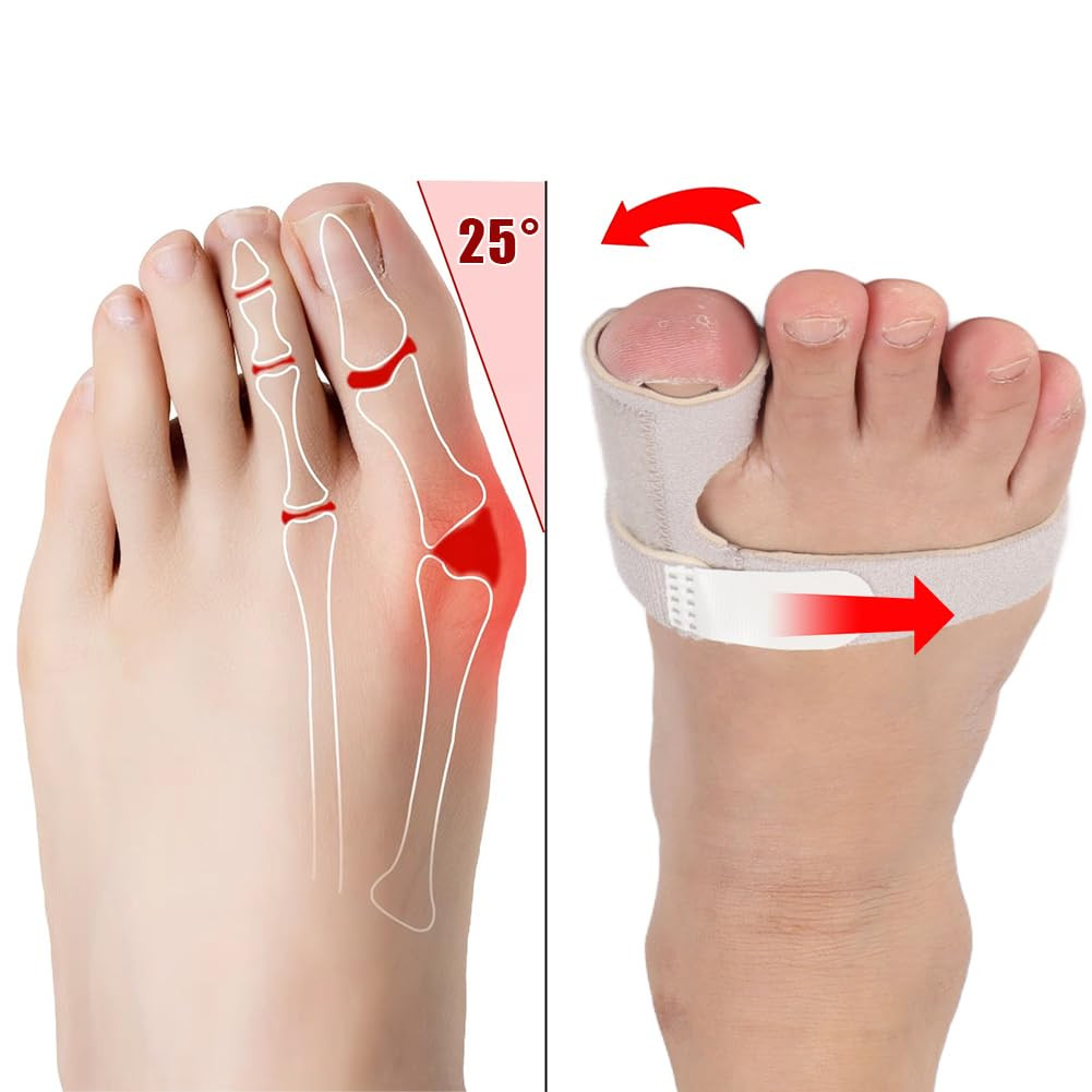 Toe Brace Splint, Adjustable Orthopedic Big Toe Straightener Support | Fracture