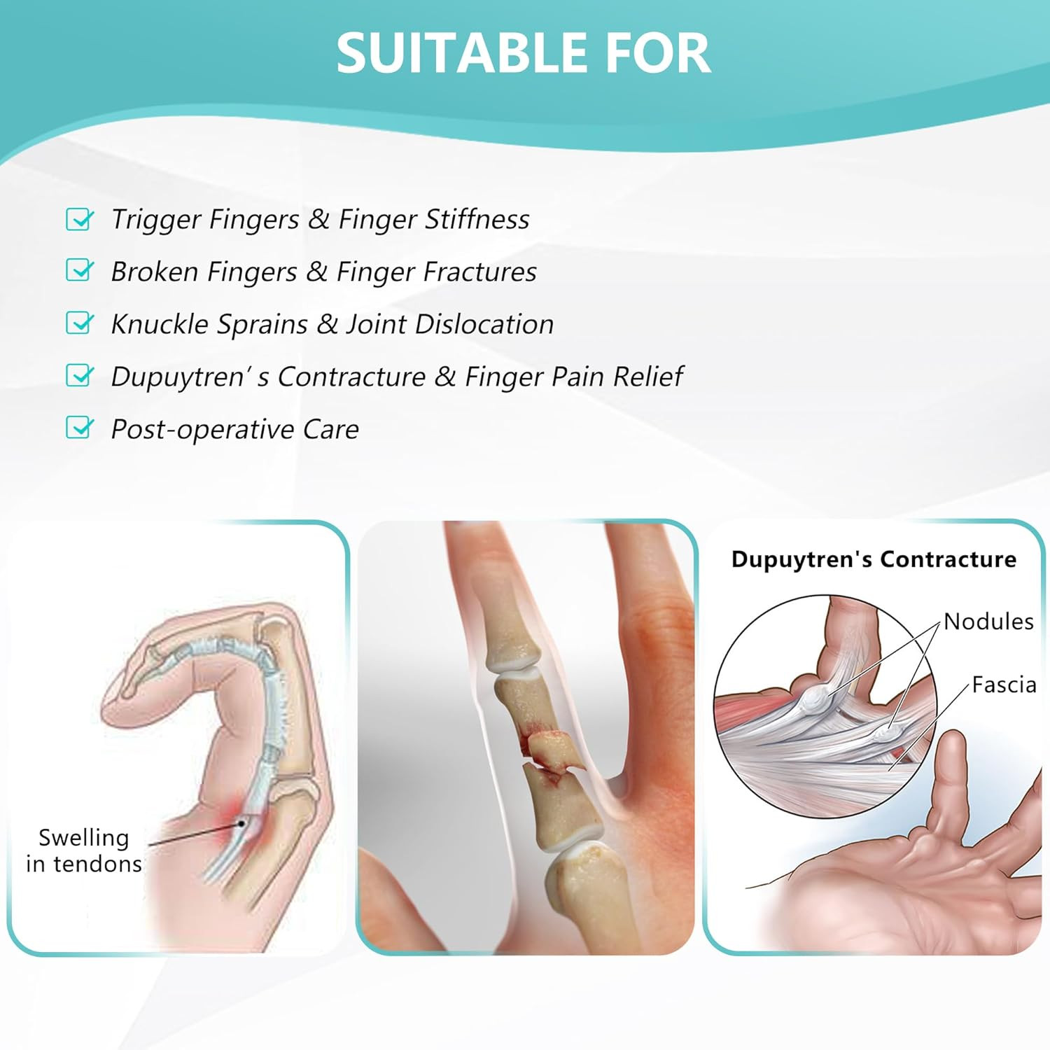 2 Finger Splint,Trigger Finger Splint,Pinky Finger Splint for Broken Finger,Adju